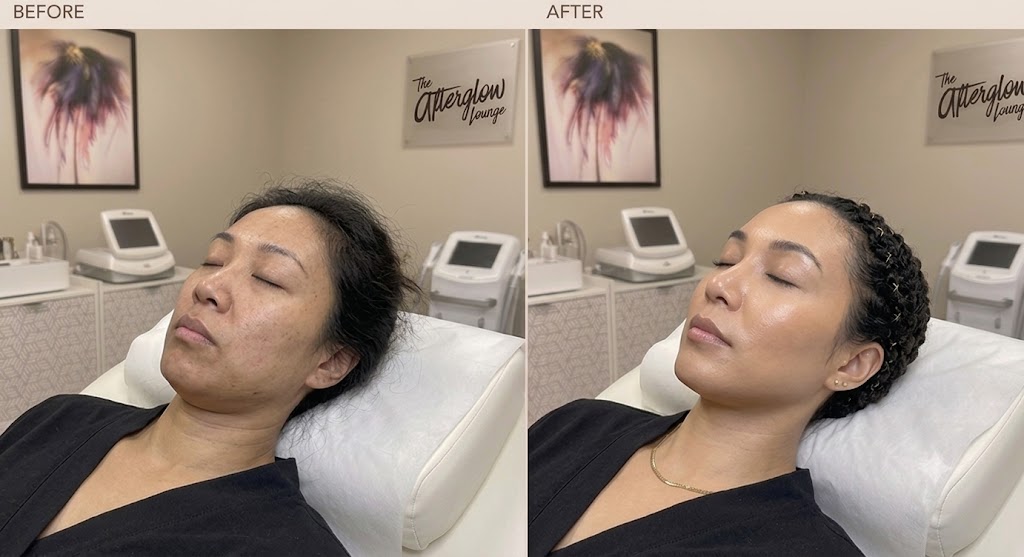 Before and after: skin tone and texture improvement after advanced facial treatment